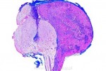 Histologia człowieka - kompletny zestaw 100 preparatów - kod 79500