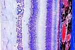 Histologia człowieka - kompletny zestaw 100 preparatów - kod 79500
